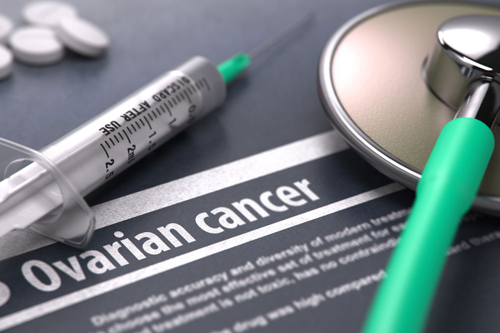 Ovarian Cancer-Risk factors and Causes