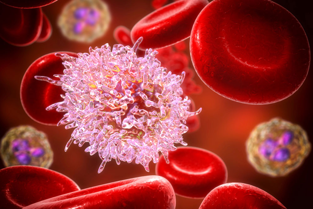 Early Warning Signs and Symptoms of Leukemia