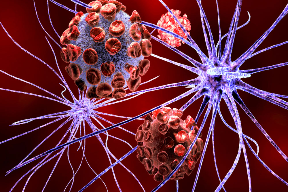 Early Warning Signs and Symptoms of Spinal Muscular Atrophy