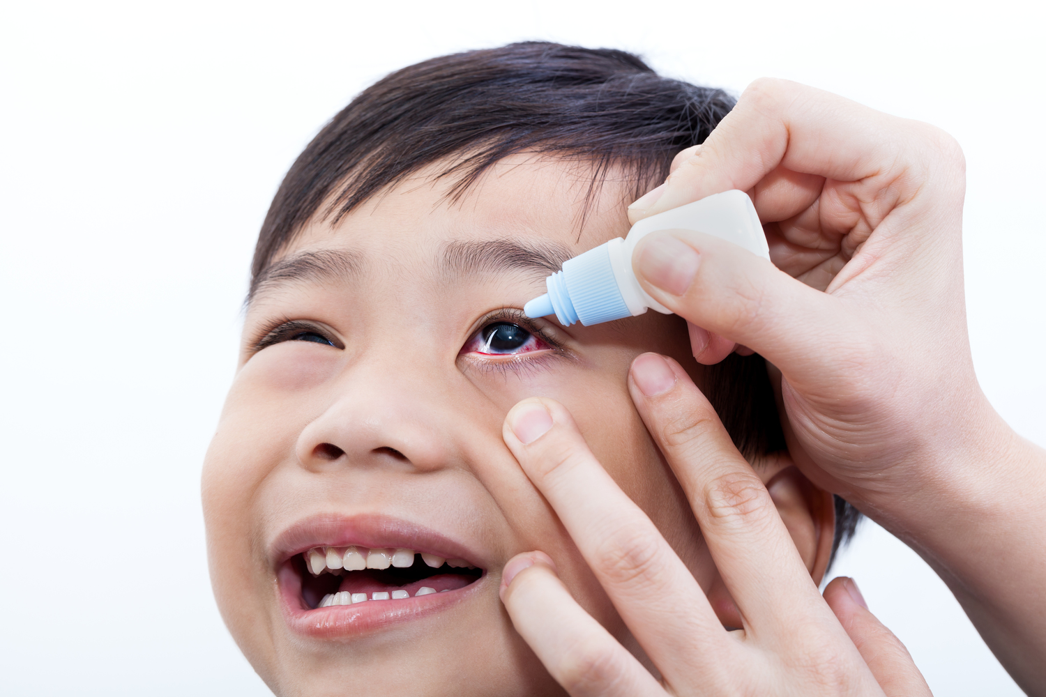 Common Symptoms of Eye Infections